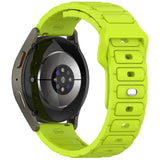 Huawei Honor Magic 2 46mm Zore KRD-132 22mm Silikon Kordon Strap Kayış